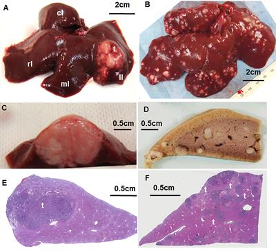 Rabbit VX2 Liver Tumor Model: A Review of Clinical, Biology, Histology, and Tumor Microenvironment Characteristics